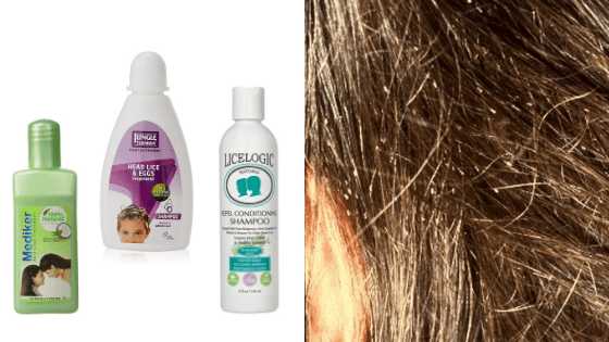Natural And Best Lice Treatment Shampoos Available In India