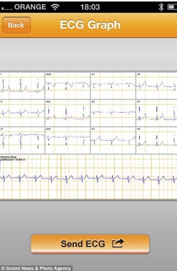 New Device Turns Your Mobile Phone Into A Heart Monitor.
