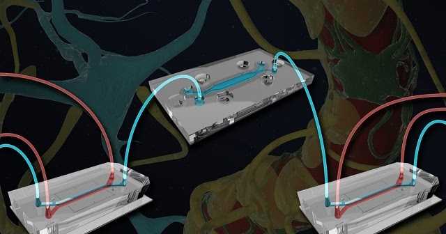 New Organ On Chip Helps Study Disease In The Brain