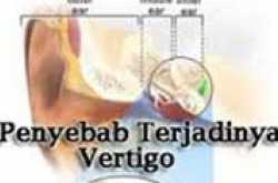 OBAT (JAMU) VERTIGO TRADISIONAL DAN ALAMI