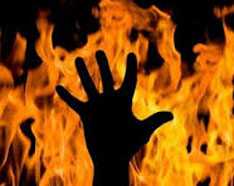 OBAT OLES “SALEP KULIT” LUKA BAKAR TRADISIONAL DAN ALAMI