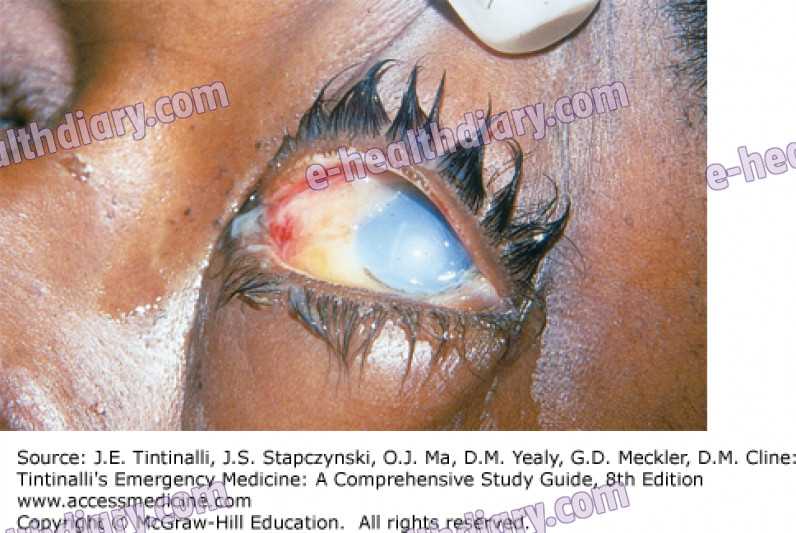 Octocrylene Scene Is Accompanied By Its Component Zinc Oxide