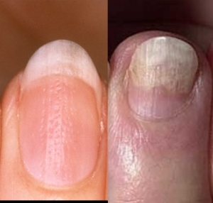 Our Nails Tell It All! - LifeCountz