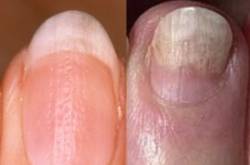 Our nails tell it all! - LifeCountz