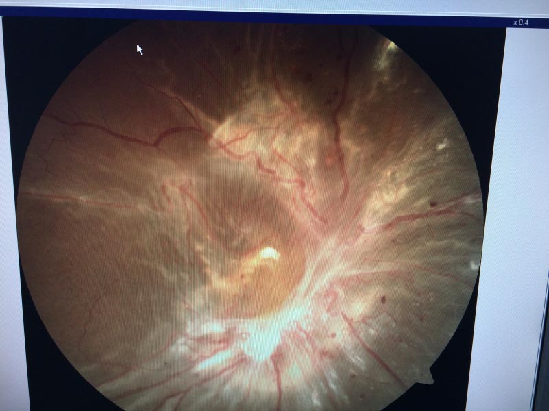 Perseverance, Motivation And Moral Support!