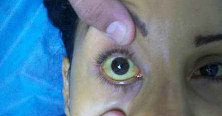 Piliya à¤à¤¾ à¤à¤¤à¤¨à¤¾ à¤à¤¸à¤¾à¤¨ Ilaj Hindi à¤®à¥à¤ à¤¨à¤¹à¥ à¤à¤¾à¤¨à¤¤à¥ à¤¹à¥à¤à¤à¥ à¤à¤ª