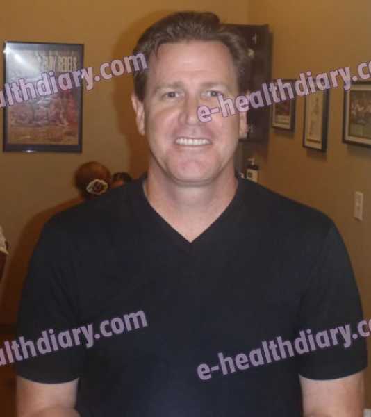 Procuring Wa Butler Co. Requires Substantial Maprotiline