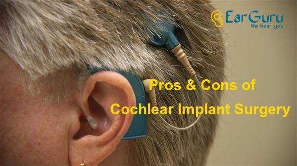 Pros And Cons Of Cochlear Implant Surgery - Earguru