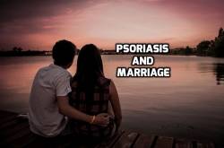 Psoriasis and Marriage: Difficulties and Solutions - Psoriasis Self Management