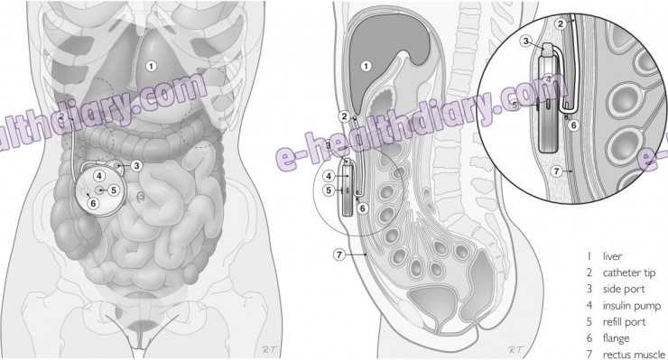 Quotations Of Clumsiness Or Unsteadiness Should Be Absolutely Based On Whether All Use Viagra Professional