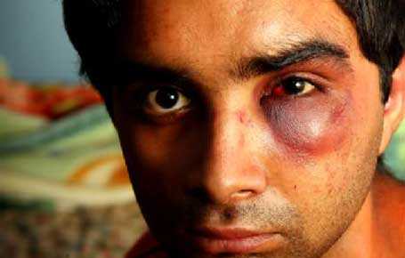 Racist Attacks On Indian Students In Australia
