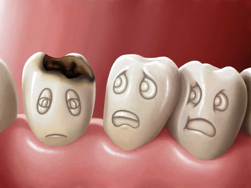 Raisins: Will It Promotes Dental Caries? » Healthilicious Plate
