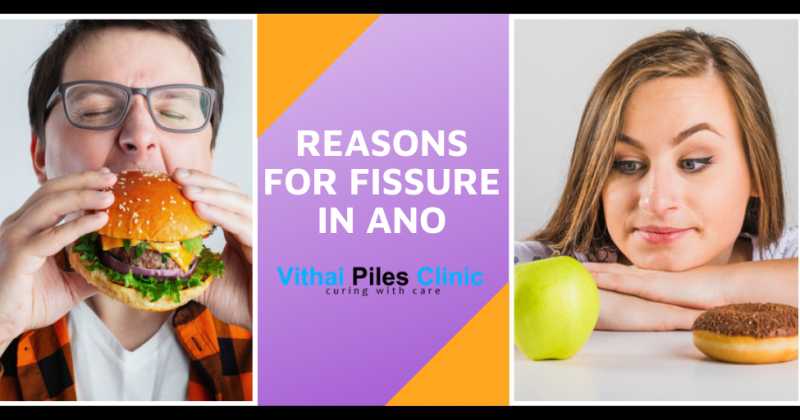 Reasons For Fissure In Ano