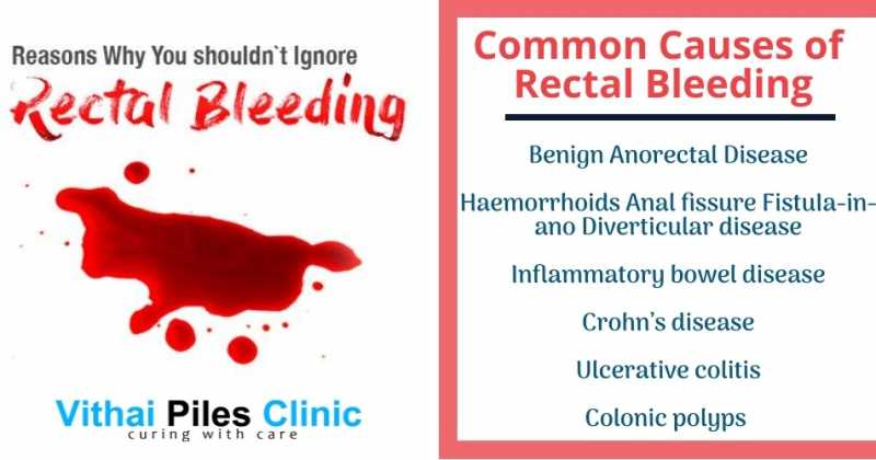 Rectal Bleeding - Causes & Treatment | Vithaipileshospital