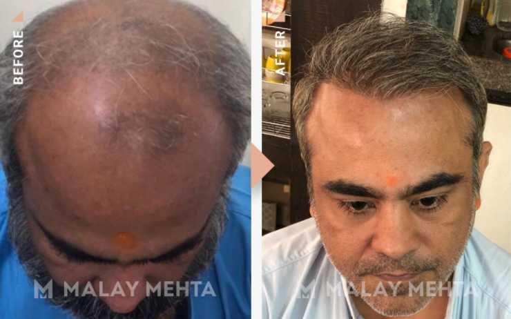 Redefine Yourself With These Trendy Hairstyle - Makeup Review And Beauty Blog