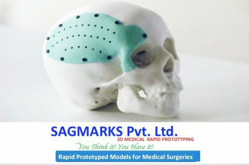 Sagmarks-Providing 3D Printed Models And Surgical Guides To The Medical Professionals