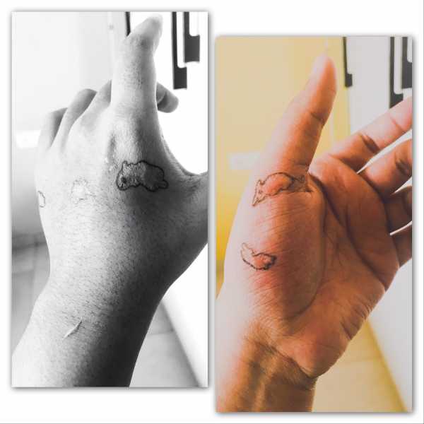 Scars Have Stories To Tell