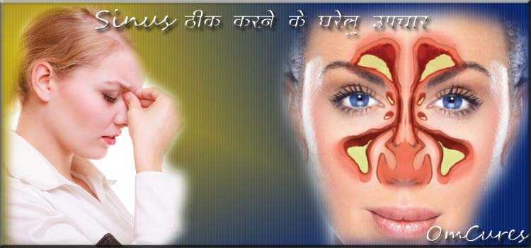Sinus Thik Karne Ke Upay | साइनस की बीमारी ठीक करने के 7 Best घरेलू उपचार
