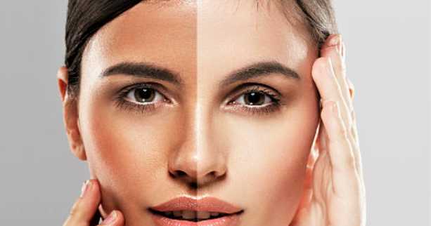 Skin Whitening Home Remedies - Must Try