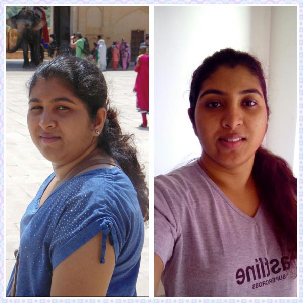 Success Story| Vrishali Mulay | Lost 11 Kgs In One Year Despite Hormonal Imbalances Due To PCOS (polycystic Ovarian Syndrome)