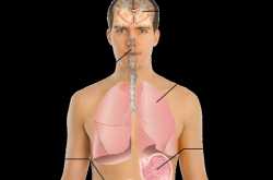 Swine influenza/Swine Flu virus - Symptoms, Causes, Vaccines, Affected areas, Treatment.