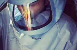 TOTAL KNEE REPLACEMENT SURGERY IN A VERY YOUNG 27 YR OLD PATIENT BY DR DEEPAK INAMDAR AT APOLLO HOSPITAL JAYANAGAR , BANGALORE