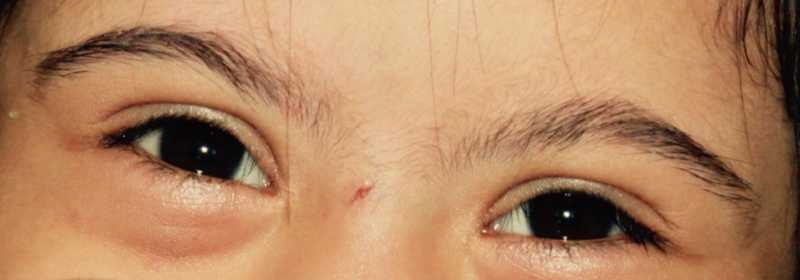 That Extra Chromosome Which Makes Her ‘Out Of The World’!