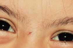 That Extra Chromosome which makes her ‘Out of the World’!