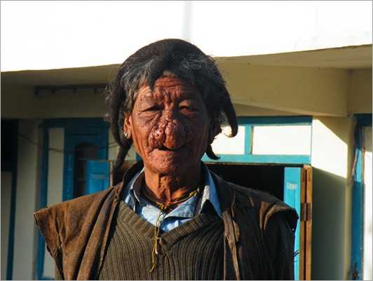 The Curious Case Of The Nosy Healer