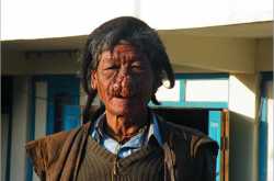 The curious case of the nosy healer