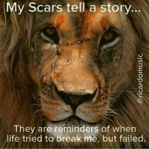 The Scars Tell A Story