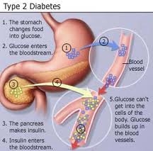 Understand Diabetes : How Could You Prevent. Controlling High Blood Pressure And High Cholesterol Is Important.
