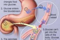 Understand Diabetes : How could you Prevent. Controlling high blood pressure and high cholesterol is important.