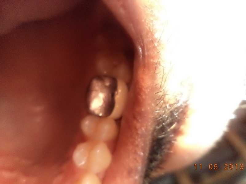 Understand!!! Or Experience???