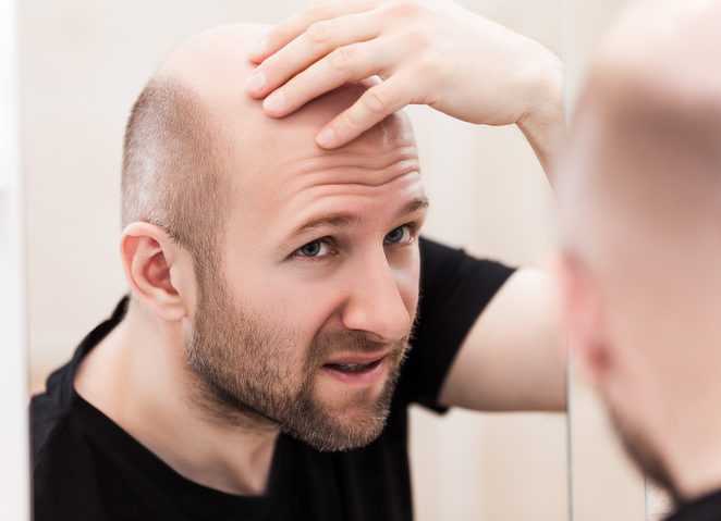Use Of Micro And Mini Grafts In Hair Transplant Surgery - Great Healthy Habits