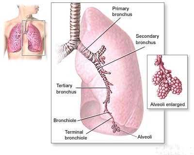 What Is Mesothelioma?