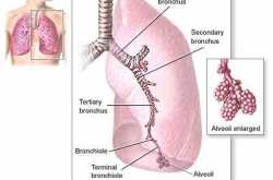 What is Mesothelioma?