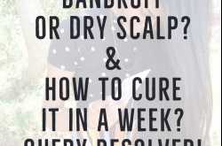 White Flakes On the Scalp - Dandruff or Just Dry Scalp? (Query)