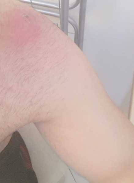 Why I Decided To Join An EHealth Startup?