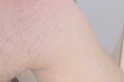 Why I Decided to Join an eHealth Startup?