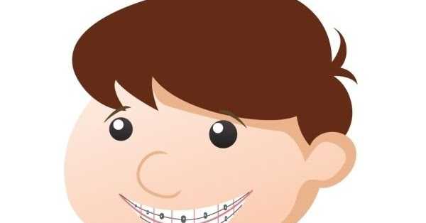 Will Dentists Do Invisalign Or Braces?