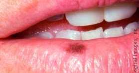 Zakhm : ज़ख्म